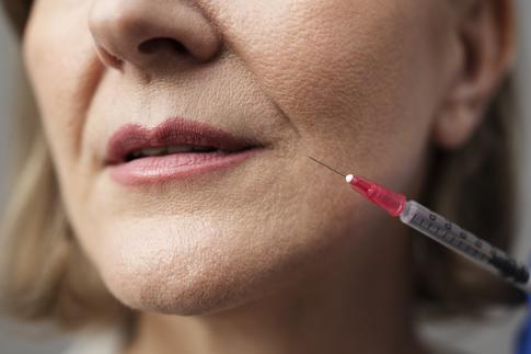Носогубки и борозды на лбу: когда ботокс будет только во вред