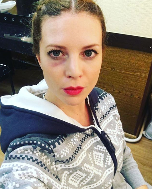 Сквозь боль и слезы: звезды, которые легли под нож хирурга