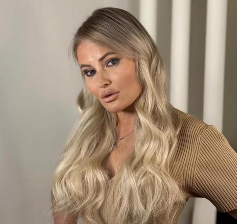 Дана Борисова чудом восстановила волосы после бьюти-процедуры с козьими экскрементами