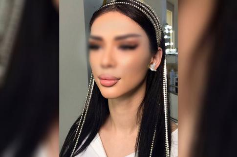 Друзья погибшей во время операции девушки рассказали, что умоляли ее не идти к косметологу