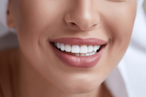 Виниры: 7 мифов о звездном тренде стоматологии