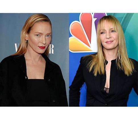 Ума Турман переколола себе ботокс